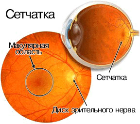 Лечение дистрофии сетчатки глаза